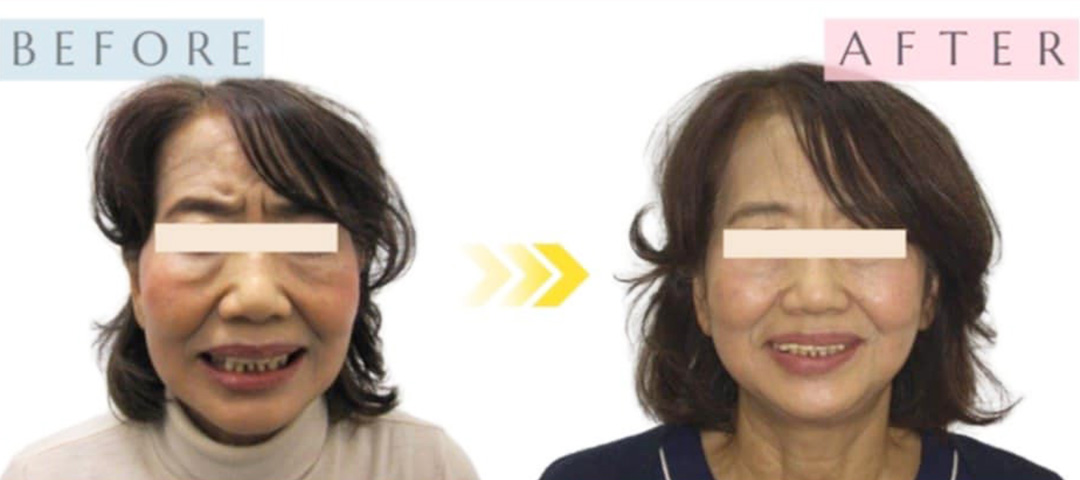 BEFORE AFTER